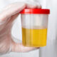 How Long Meth Stays in Urine and Drug Detection 97 how long does meth stay in urine featured image